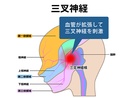 頭痛のメカニズム