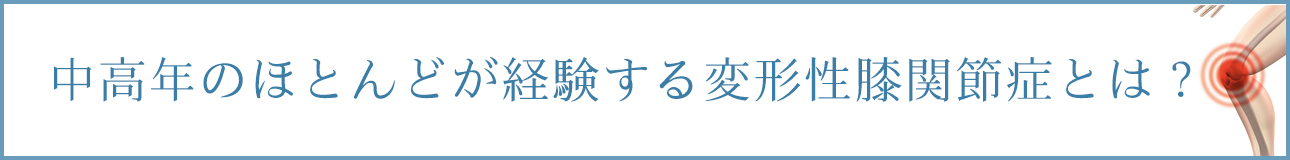 中高年のほとんどが経験する変形性膝関節症とは？