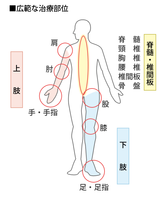 整形外科の治療部位