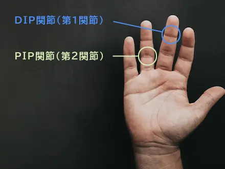 突き指を医学用語的に言うと?