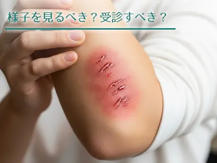 血が止まっていても油断は禁物？受診が必要な深い切り傷とは