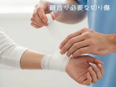 縫う必要があるかの判断基準とは？